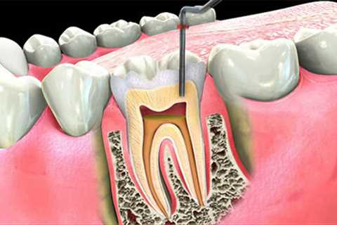 Standard post published to Symeou Dental Center at August 16, 2023 10:00
