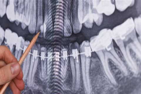 What kind of x-rays do dentists take?