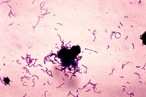 Streptococcus mutans