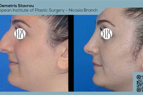 Standard post published to Dr. Demetris Stavrou - European Institute of Plastic Surgery - Nicosia..