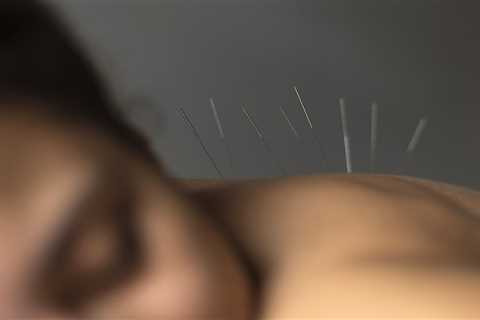 THE BENEFITS OF ACUPUNCTURE FOR CHRONIC PAIN IN CANCER SURVIVORS