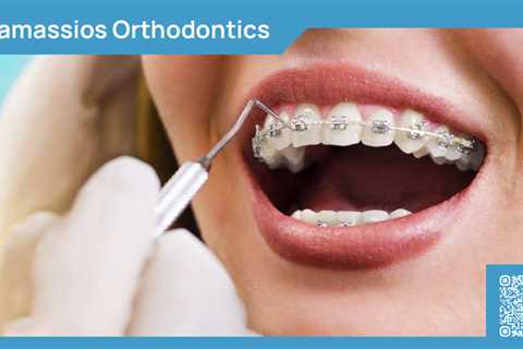 Standard post published to Tamassios Orthodontics - Orthodontist Nicosia, Cyprus at February 23,..