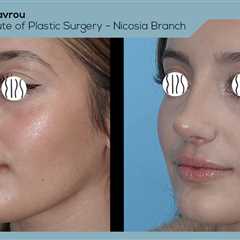 Standard post published to Dr. Demetris Stavrou - European Institute of Plastic Surgery - Nicosia..