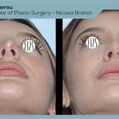 Standard post published to Dr. Demetris Stavrou - European Institute of Plastic Surgery - Nicosia..