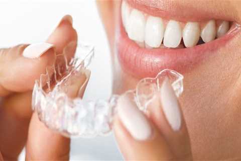 Straight To The Point: Finding Your Invisalign Dentist In Gainesville, VA