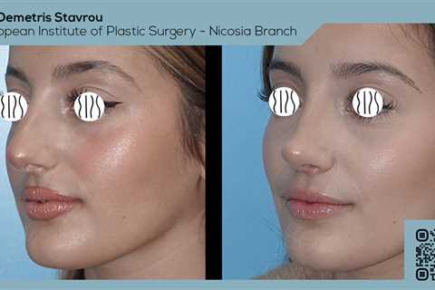 Standard post published to Dr. Demetris Stavrou - European Institute of Plastic Surgery - Nicosia..