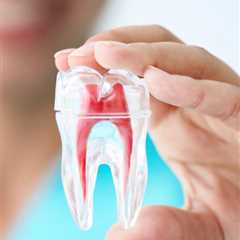 Root Canal Therapy | Perth, Rivervale, Belmont, And Burswood