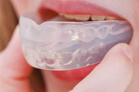 Mouthguard Creation | Open 7 Days/Week | Perth WA