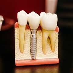 Benefits Of Aftercare For Dental Implants: A Guide From The Best Dentist In Kota Kinabalu