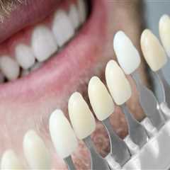 Revamp Your Smile With Dental Veneers And Teeth Whitening In Sydney