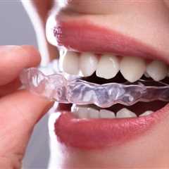 How Clear Aligners Have Evolved: Innovations in Orthodontic Treatment
