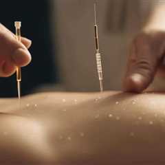 Combining Acupuncture and CBD for Pain Relief