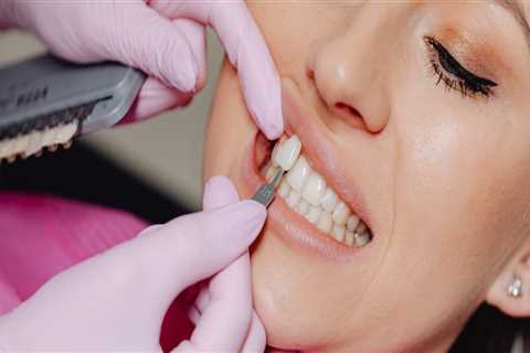 When Dental Veneers Need Urgent Attention: Ashburn VA's Emergency Dentist