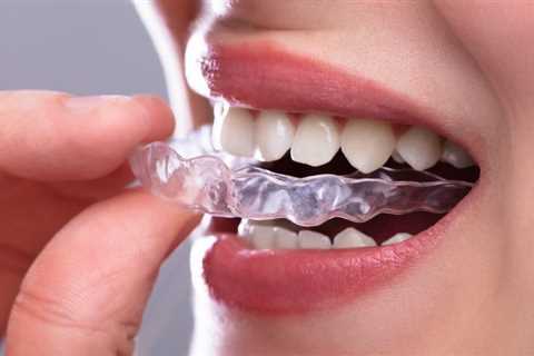 How Clear Aligners Have Evolved: Innovations in Orthodontic Treatment