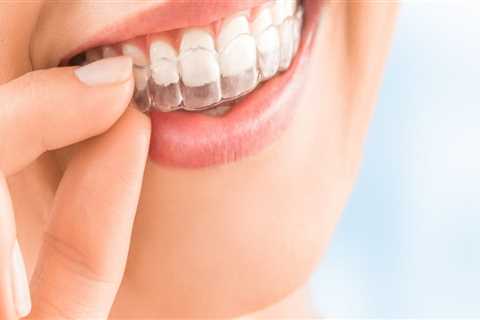 Straighten Your Smile: Finding The Best Invisalign Dentist In Edmonds