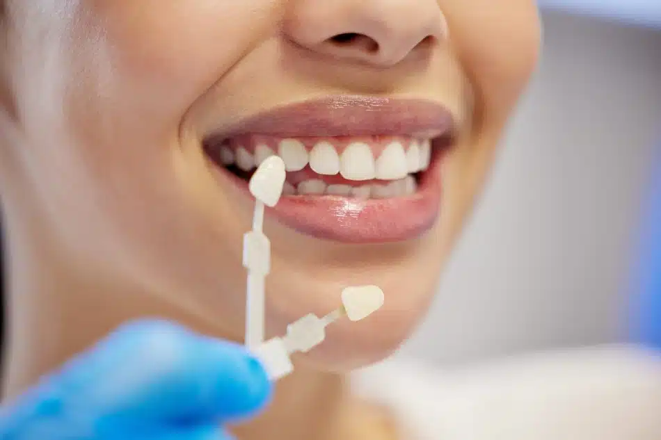 Can Veneers Fix My Teeth? Understanding Their Limitations and Capabilities