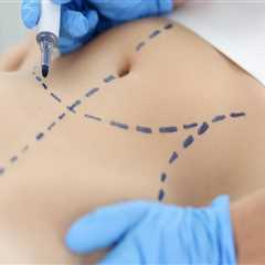 Tummy Tuck Surgery In New Jersey: The Superior Option To Nonsurgical Fat Reduction For A Sculpted..