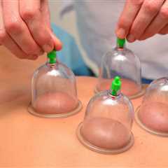 What Is Cupping?