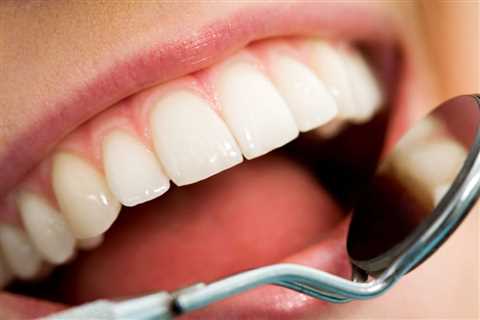 The Benefits of Invisalign for Brides-to-Be: Get a Perfect Smile Before Your Big Day