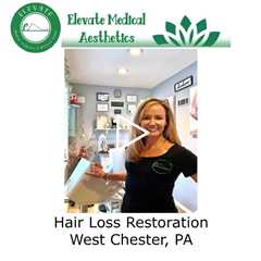 Hair Loss Restoration West Chester, PA - Elevate Medical Aesthetics