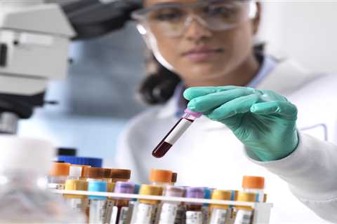 Breakthrough Pancreatic Cancer Blood Test Trial Seeks Participants for Early Detection