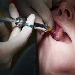 Top Reasons The Best Dental Clinic In Basel Leads In Dental Health Care