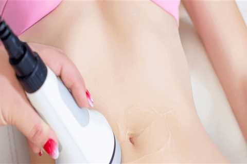 How Laser Liposuction Supports Subtle Body Contouring Over Drastic Changes