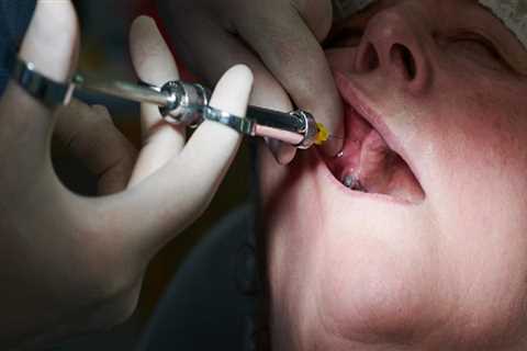 Top Reasons The Best Dental Clinic In Basel Leads In Dental Health Care