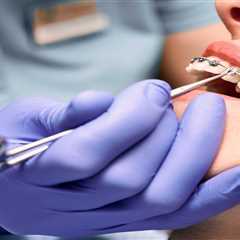 Dealing with Broken Brackets or Wires on Standard Braces