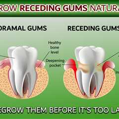 A New Approach To Gum Health: Repairing Gum Recession