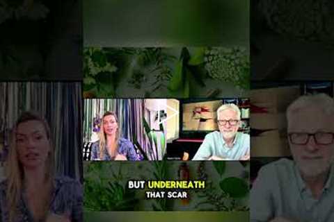 Face Your Scars: Uncomfortable Truths Heal Deeper Wounds #shorts