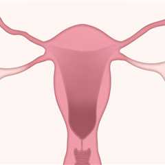 Advancing Cervical Cancer Treatments in Lake Worth