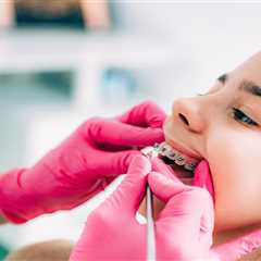 How Sanger Orthodontists Customize Traditional Braces for Comfort and Results