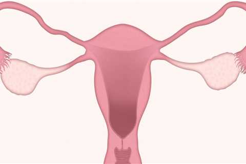 Advancing Cervical Cancer Treatments in Lake Worth