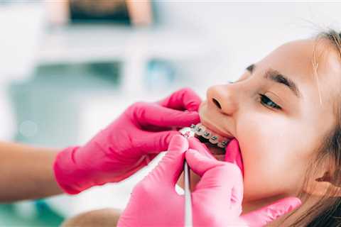 How Sanger Orthodontists Customize Traditional Braces for Comfort and Results