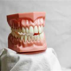 Explore Your Options for Wisdom Teeth Removal and Full Mouth Implants