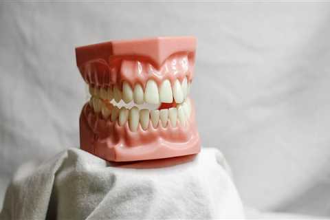 Explore Your Options for Wisdom Teeth Removal and Full Mouth Implants