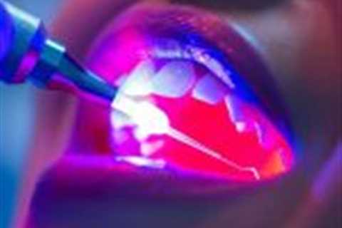 Laser dentistry